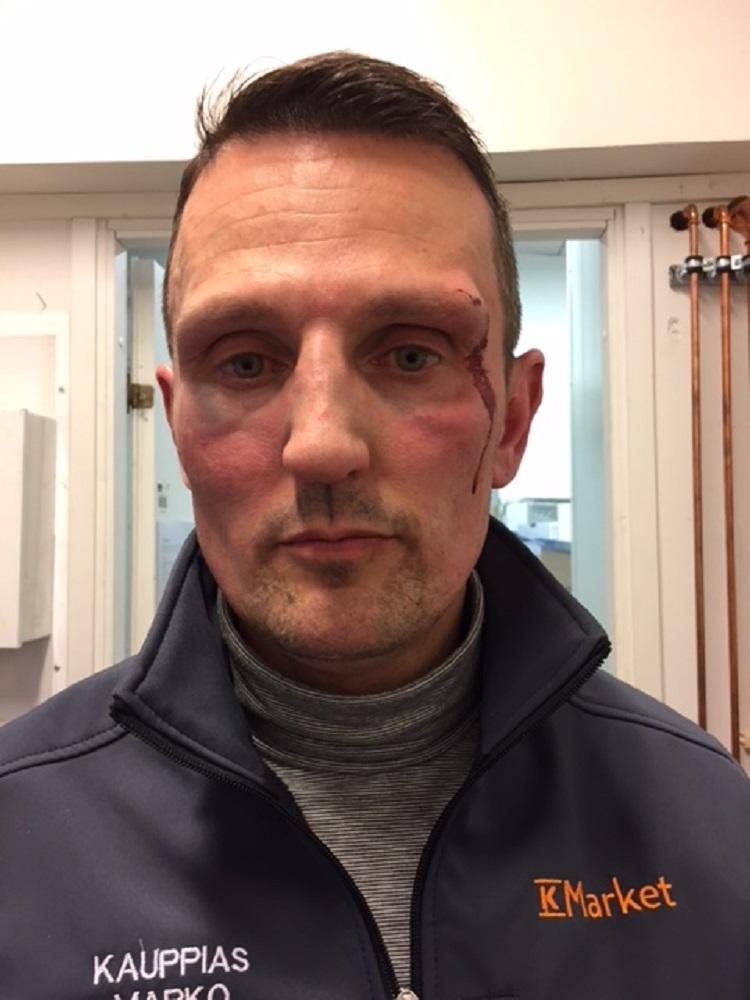 Marko Hoikkaniemi sai helmikuussa iskuja kaljavarkaalta niin, että silmälasit hajosivat.