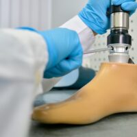 Hyvinvointialueen säästöt näkyvät proteesia käyttävän yrittäjän arjessa